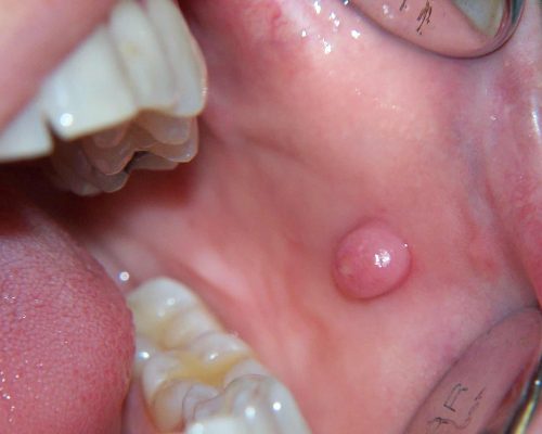 Medicina Oral 03