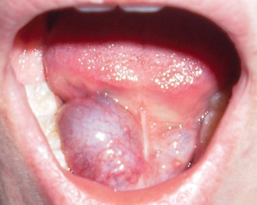 Medicina Oral 04