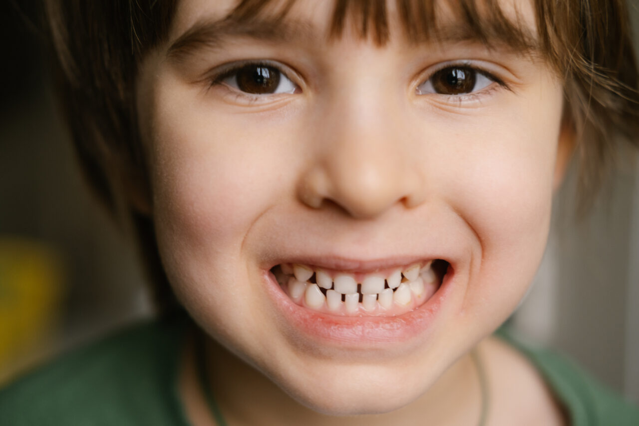 Close Up Headshot Of Little Preschool Cute Boy Widely Smiling, Showing The First Baby Milk Teeth. Happy Four Or Five Years Old Small Adorable Cutie Toddler With Primary Teeth. Portrait.